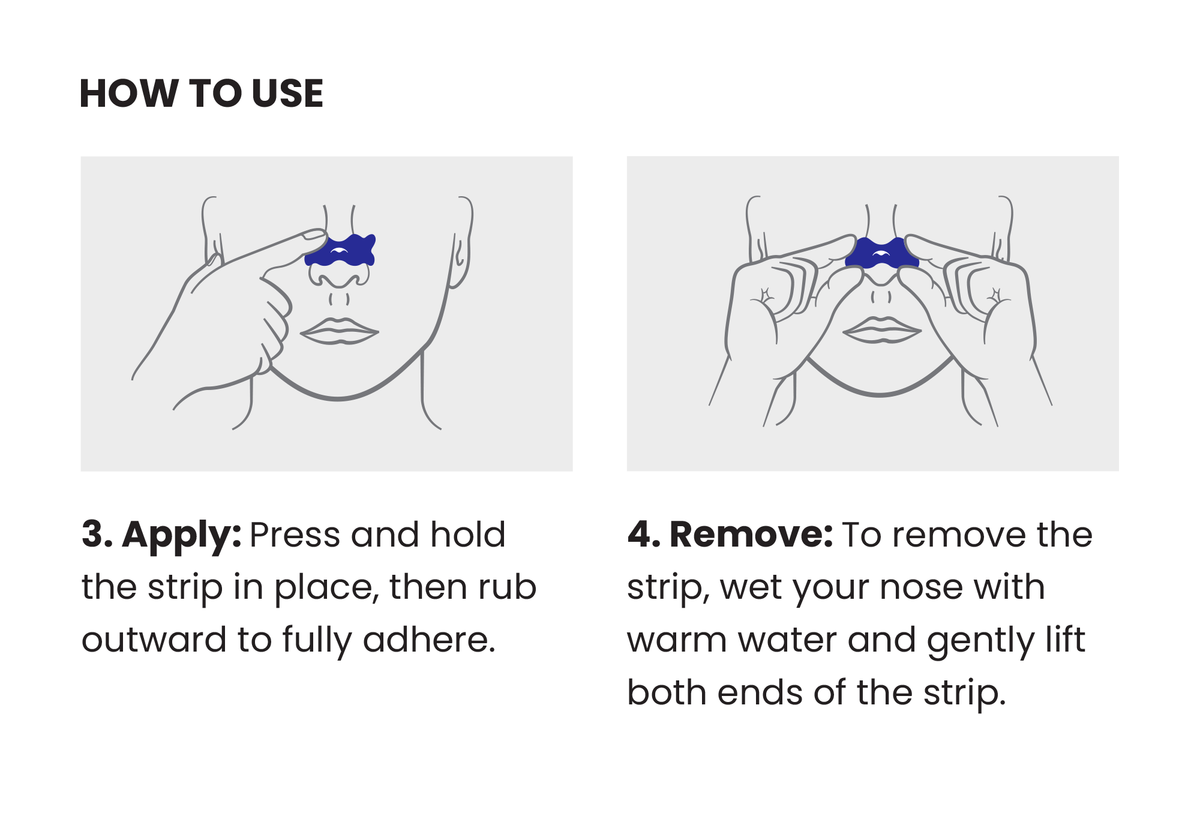 Manta Nasal Strips