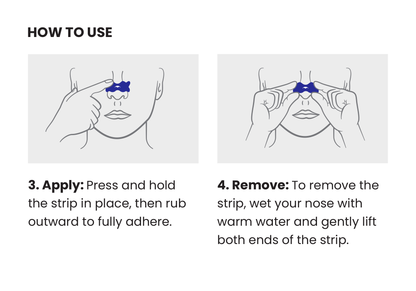Manta Nasal Strips